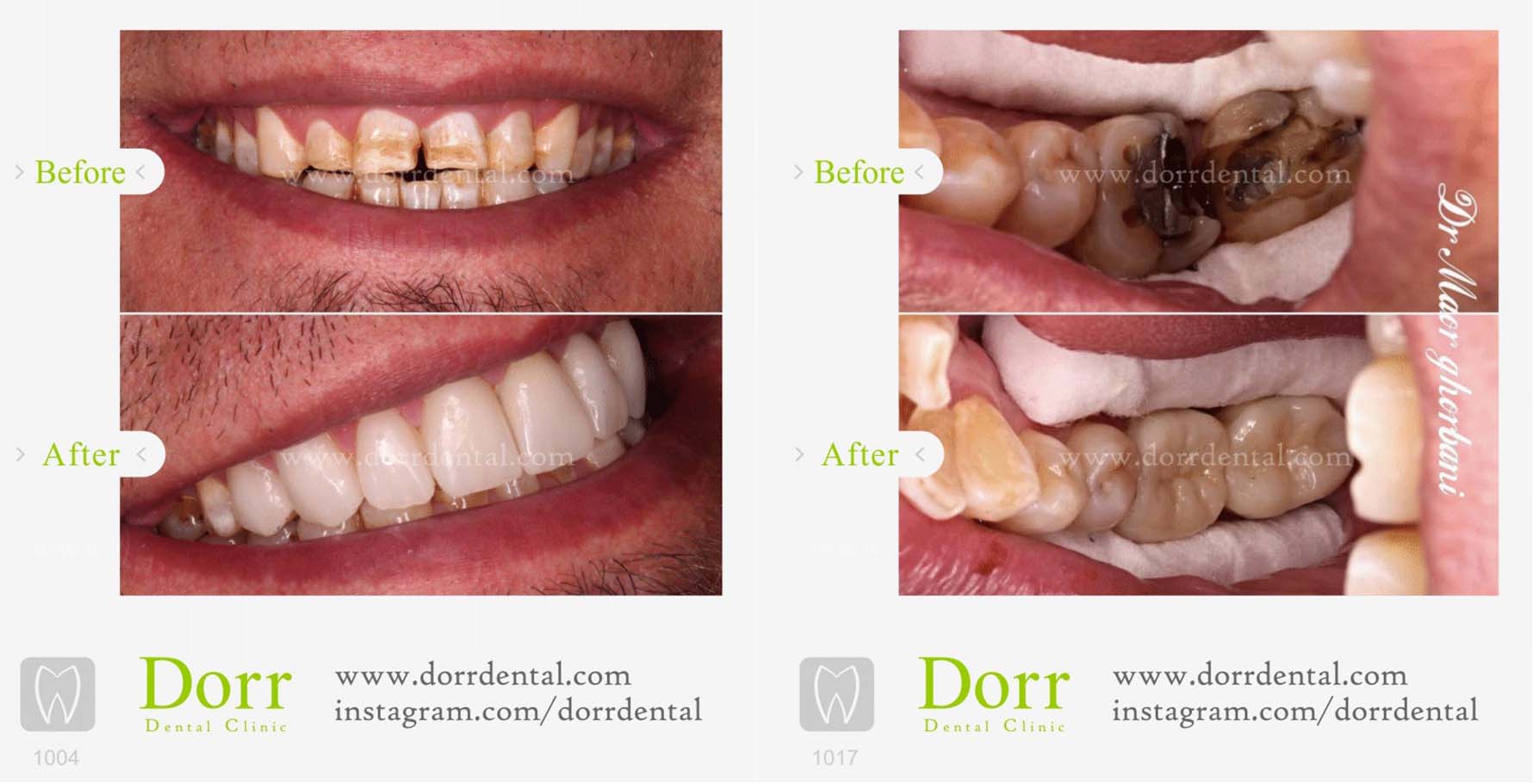 دکتر ماهور قربانی متخصص ترمیم و زیبایی دندان در ولنجک
