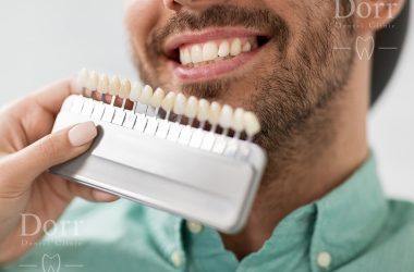 Are dental veneers worth it